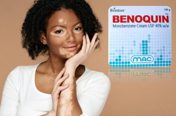 Get Glowing with Monobenzone Cream: The Skincare Miracle You've Been Missing!