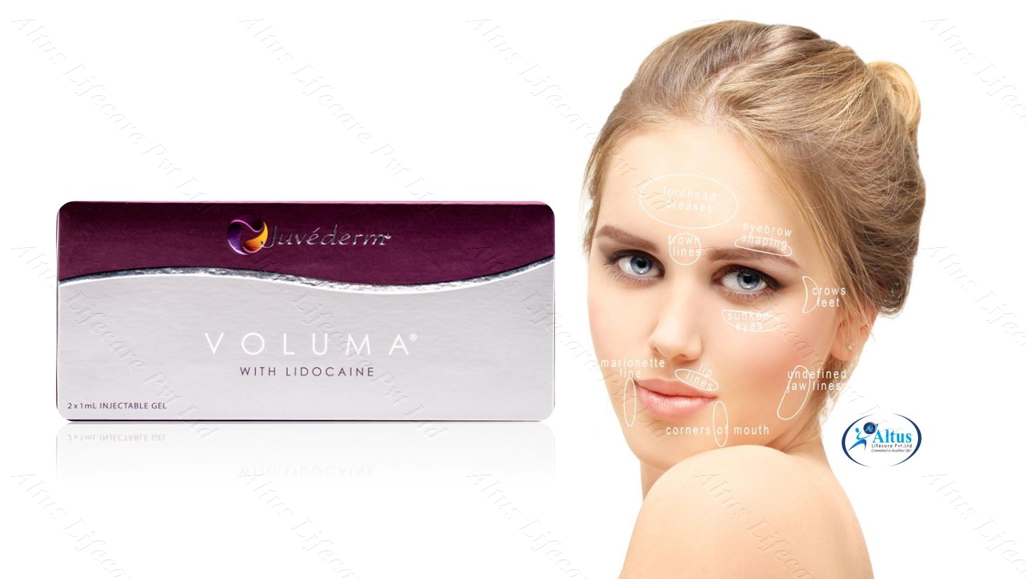 Juvederm Voluma Unveiled: The Ultimate Guide to Stunning Results