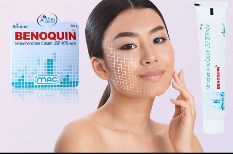 Benoquin Cream 17