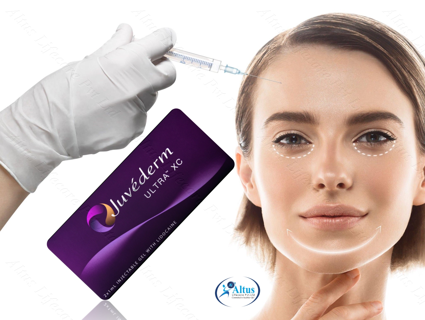 Juvederm Ultra XC Injection 14 1