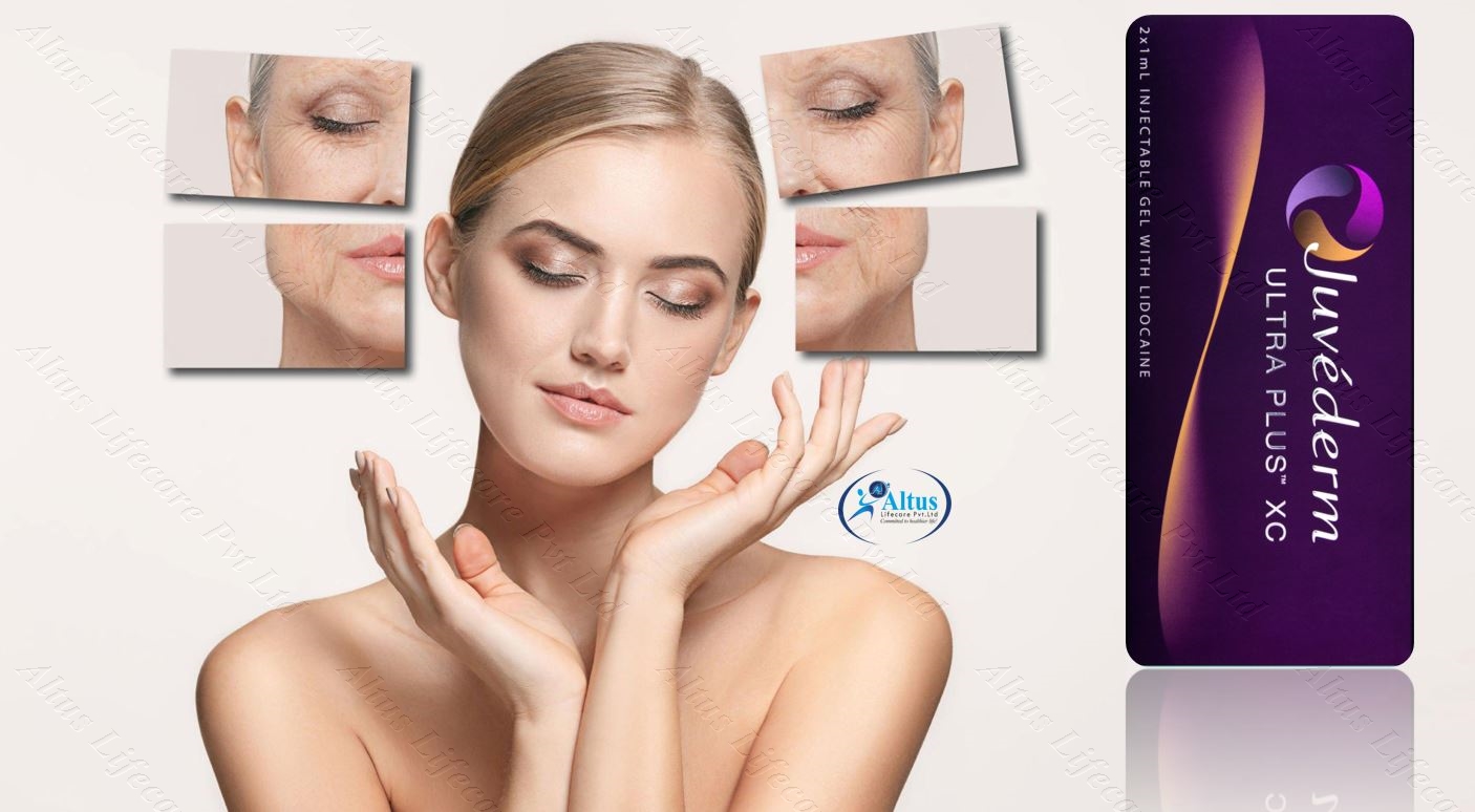 Juvederm Ultra XC Injection 3 2