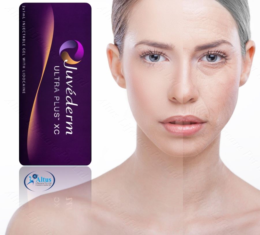 Juvederm Ultra XC Injection: Your Secret to Plump, Youthful Skin