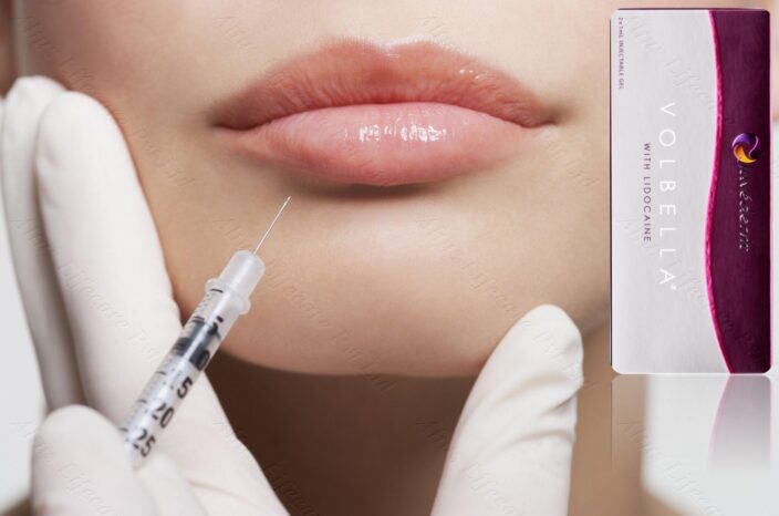 "Discover the Beauty of Juvederm Volbella XC: Unveil Radiant Lips and Soften Fine Lines for a Stunning Transformation!"