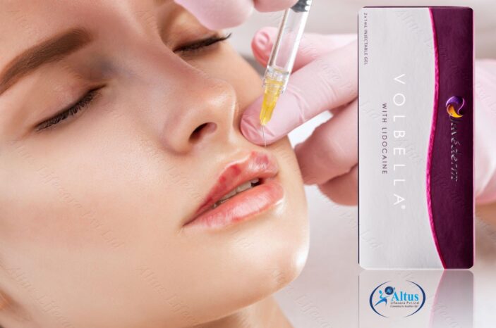 "Discover the Beauty of Juvederm Volbella XC: Unveil Radiant Lips and Soften Fine Lines for a Stunning Transformation!"