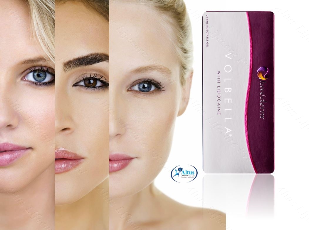 Juvederm Volbella Injection 22