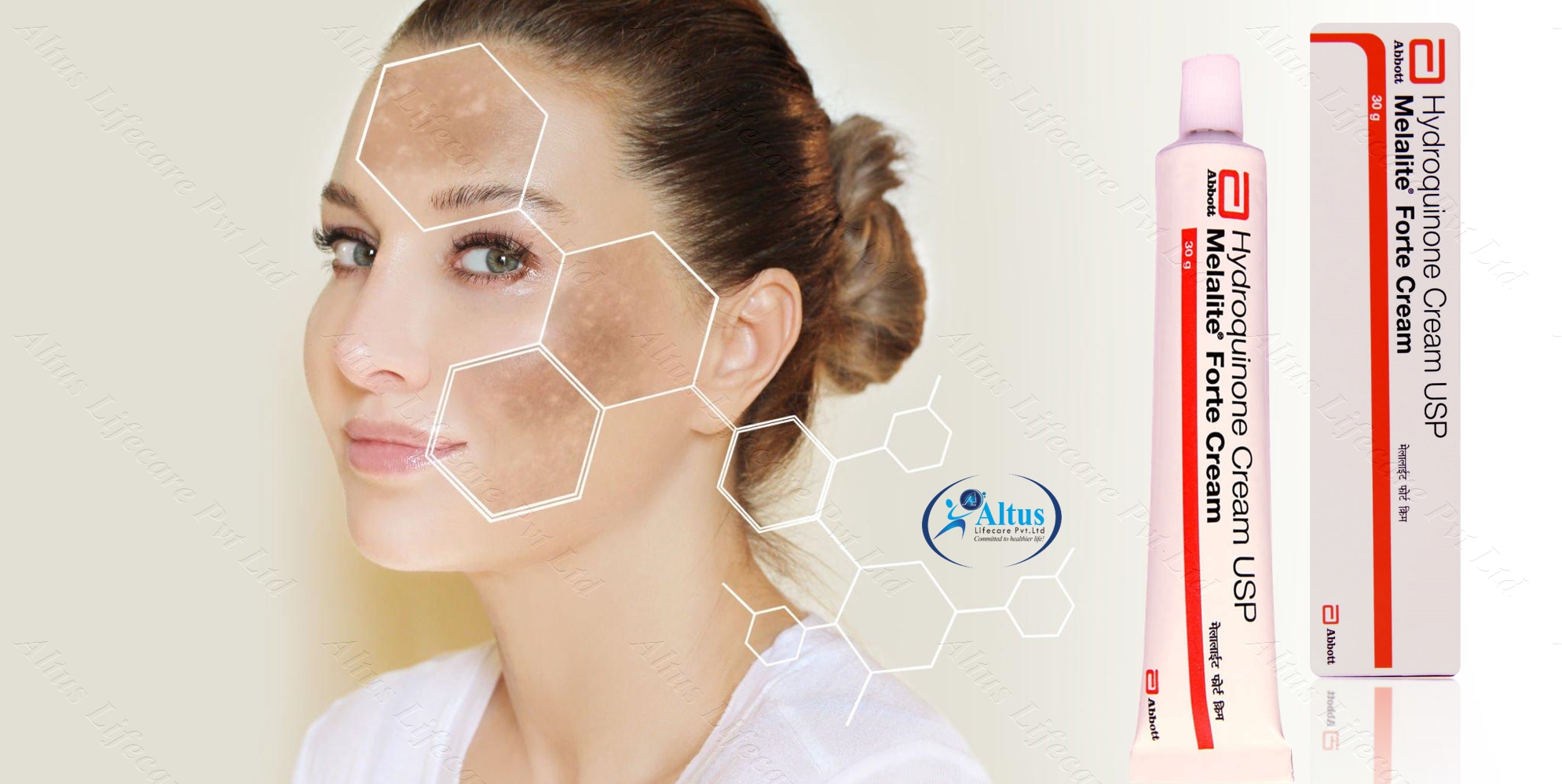 “Melalite Fort Cream Hydroquinone: A powerful skin lightening treatment for hyperpigmentation