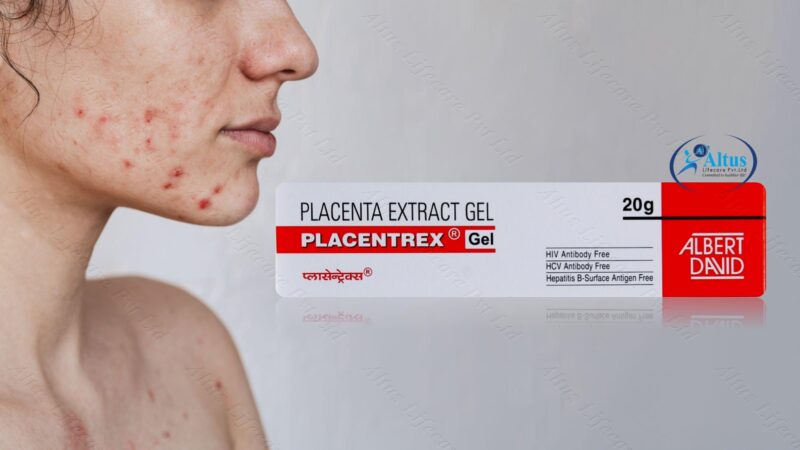 Placentrex Gel 11