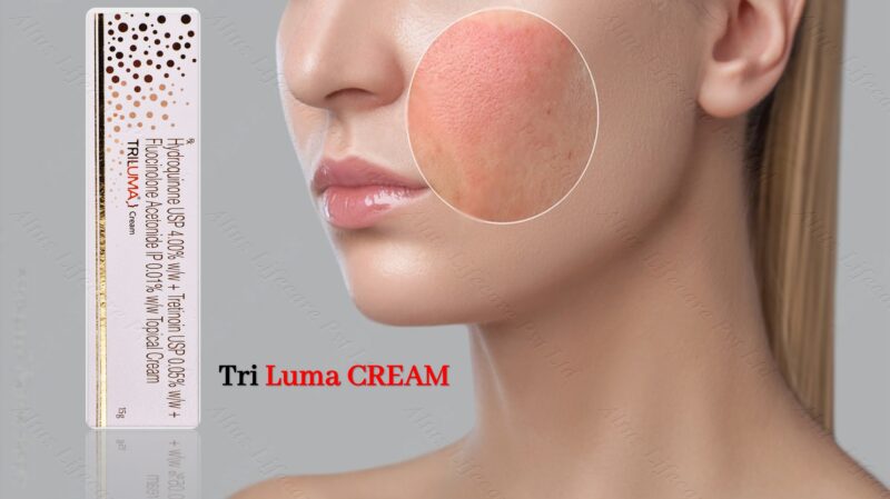 Triluma Cream 10