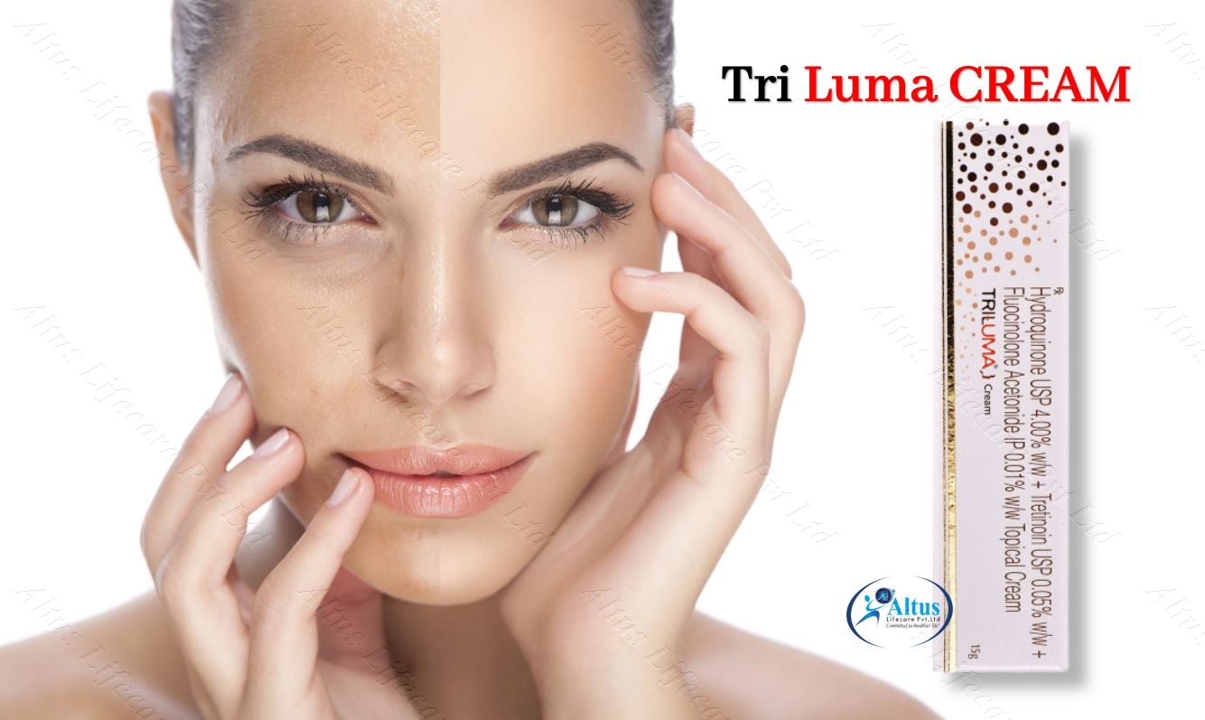 Triluma Cream: The Skincare Secret Every Beauty Enthusiast Should Know