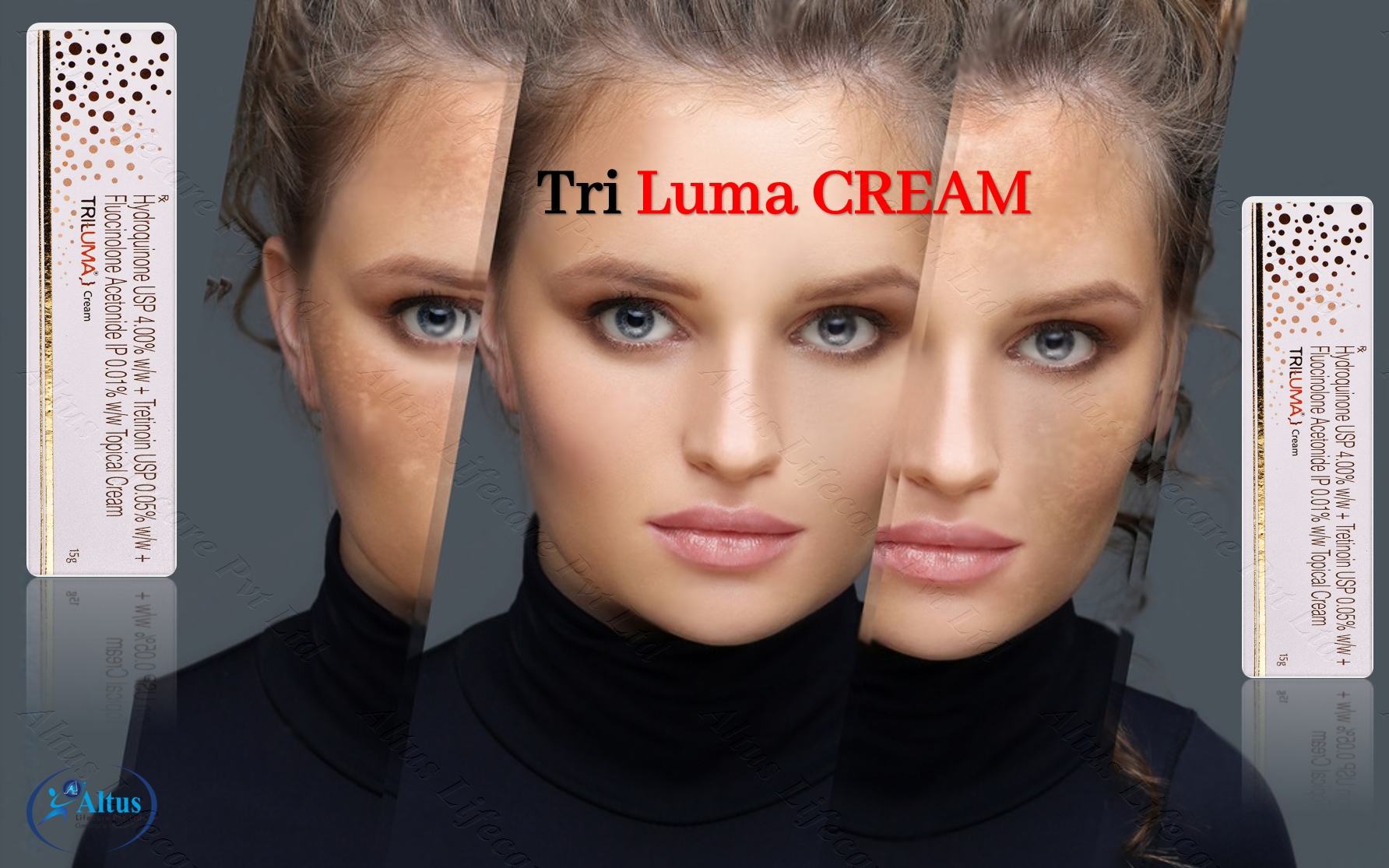 Triluma Cream Unleashed: A Breakthrough for Uneven Skin Tone