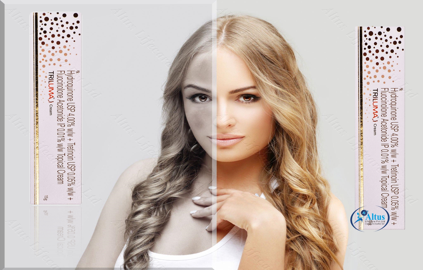 Triluma Cream: The Skincare Secret Every Beauty Enthusiast Should Know | Melasma